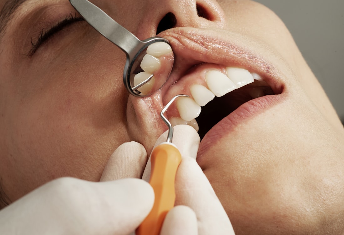 Dental Checkup Package
